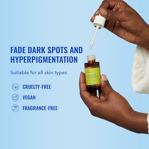 Face Serum | Tranexamic Acid, Niacinamide, Dark Spot Treatment