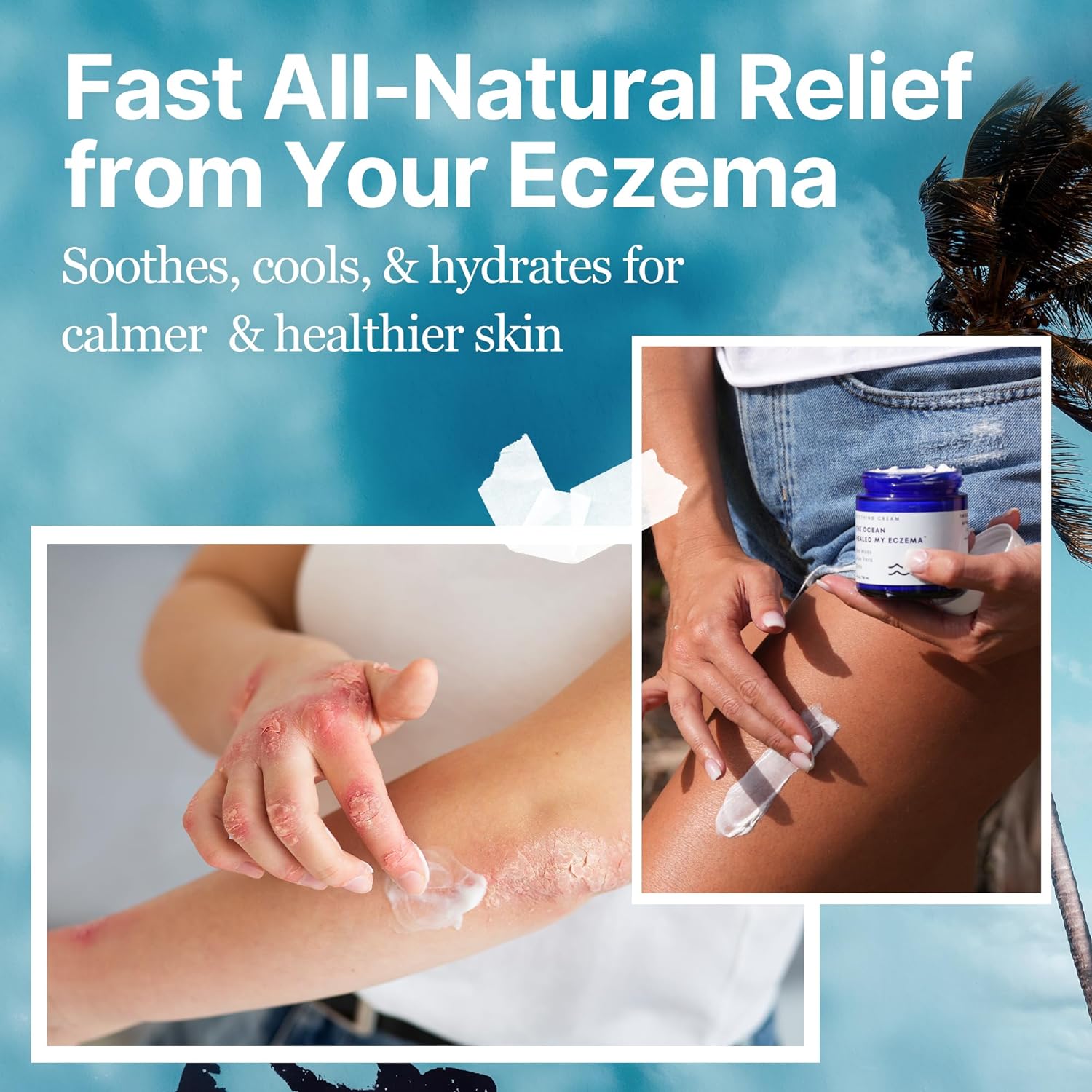 Sea Moss & Oats Eczema Cream | Hydrate Sensitive Skin, 4 Oz